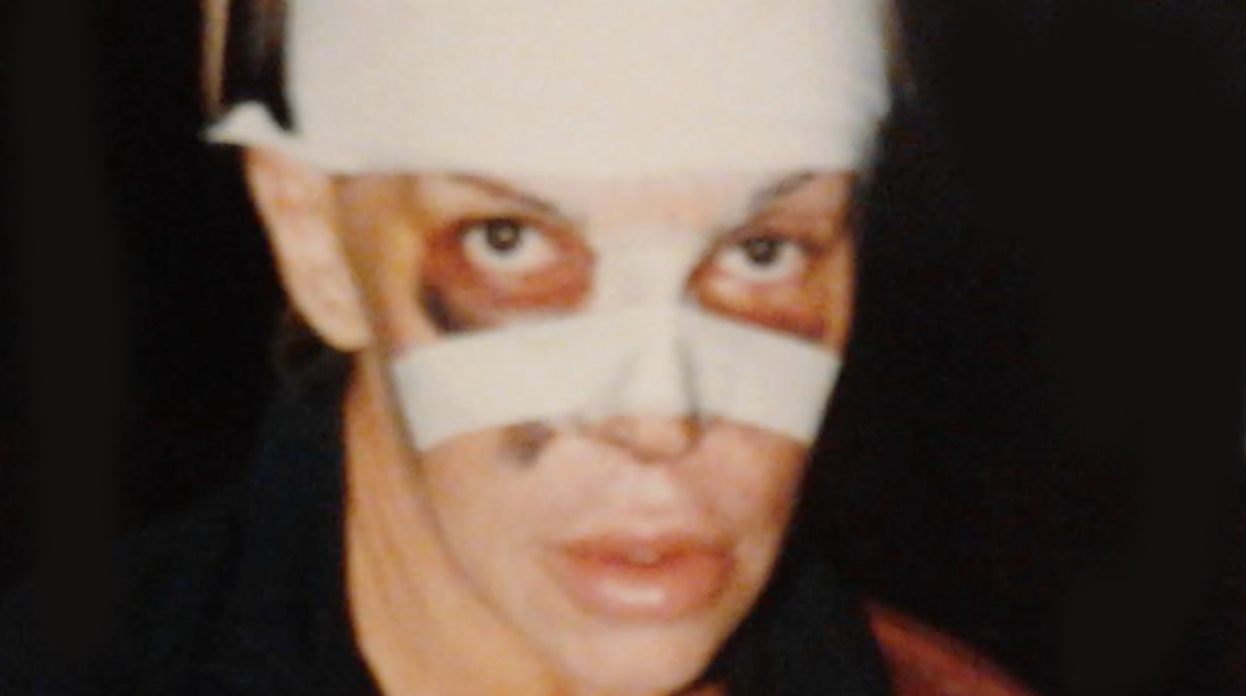 Fulvia-Pellegrino-Chirurgie-Trans-2